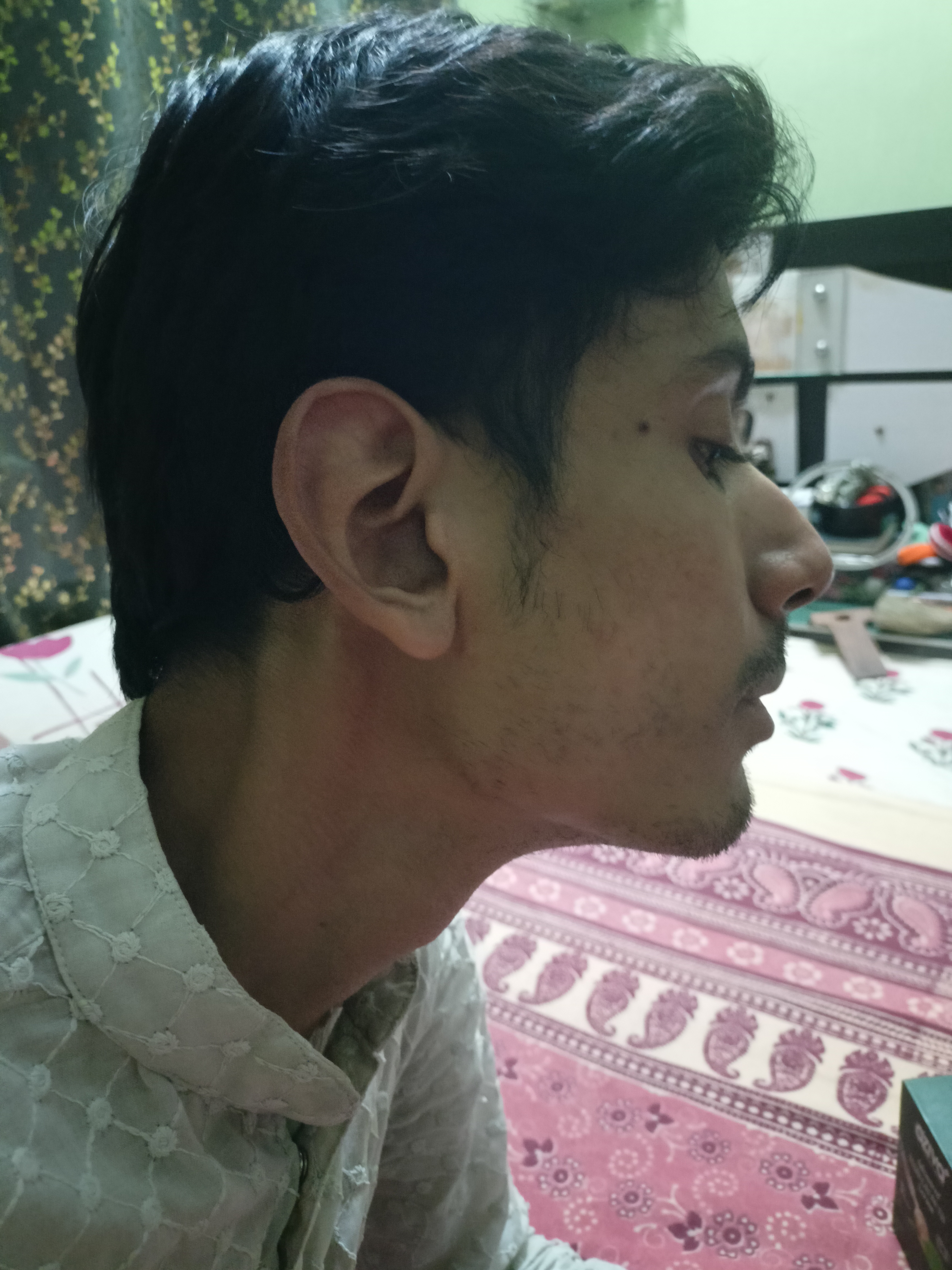 Patient Testimonial